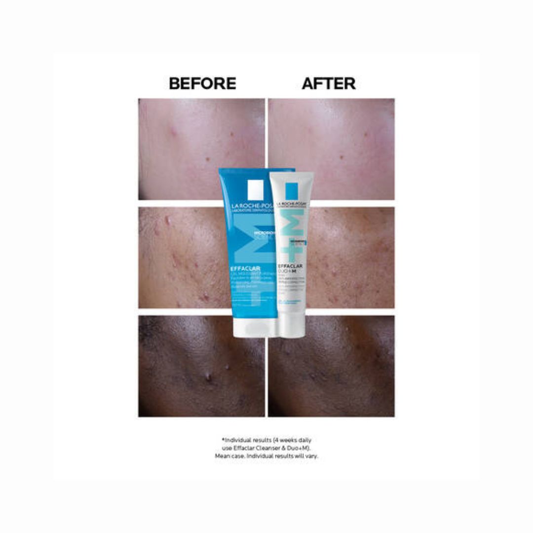 La Roche-Posay Effaclar Duo+M Anti Blemish Gel 40ml